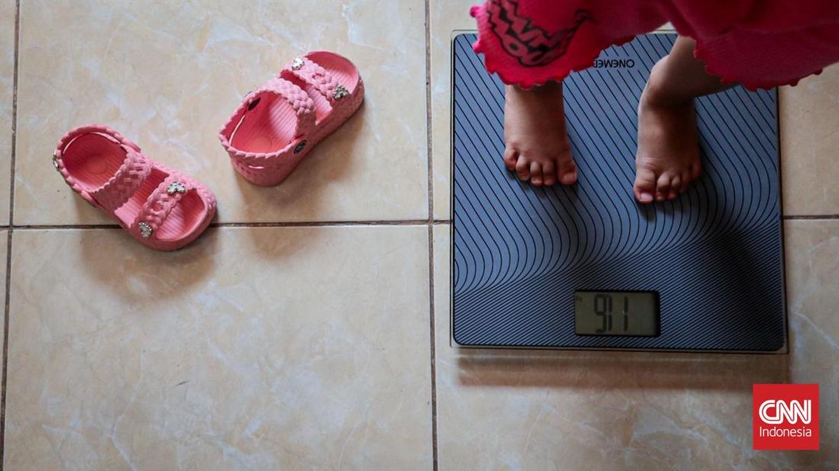 Risiko Gangguan Otak pada Anak Stunting dan Tantangan Kesehatan di Indonesia