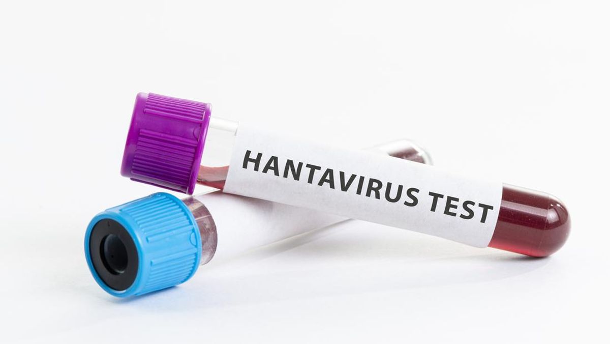 Mewaspadai Penularan Hantavirus: Antara Hewan dan Manusia