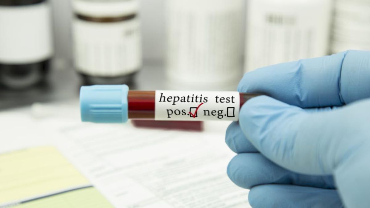 Hepatitis: Penyakit Diam yang Sulit Terdeteksi