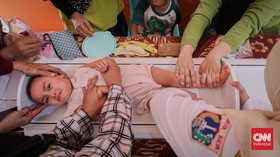 Pentingnya Pemeriksaan Kesehatan Anak untuk Cegah Stunting pada Hari Balita Nasional