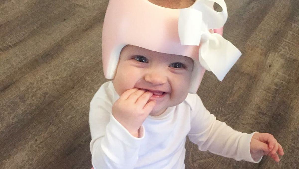 Helm Khusus untuk Bayi: Kebutuhan Medis atau Sekadar Tren?