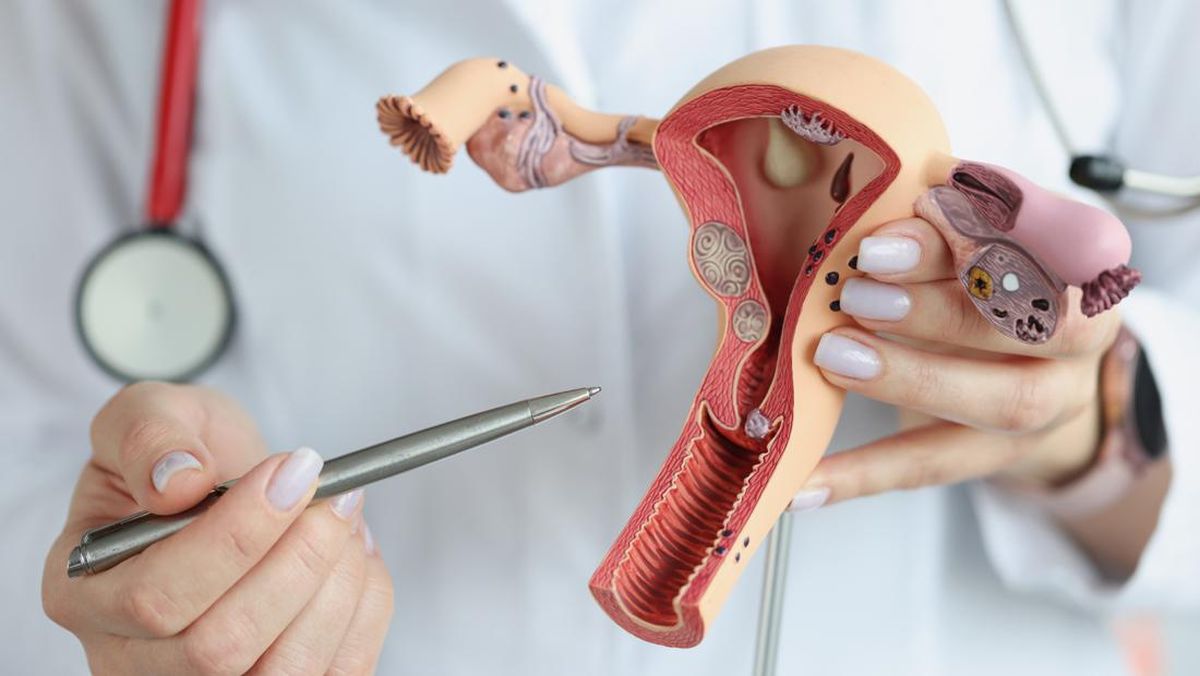 Pentingnya Pap Smear untuk Deteksi Dini Kanker Serviks
