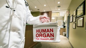 Selain Ginjal, Ini 4 Organ yang Bisa Didonorkan Saat Kamu Masih Hidup