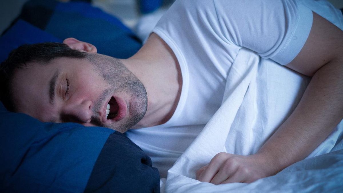 Mendengkur Bisa Jadi Tanda Serius, Risiko Stroke Meningkat Tiga Kali Lipat