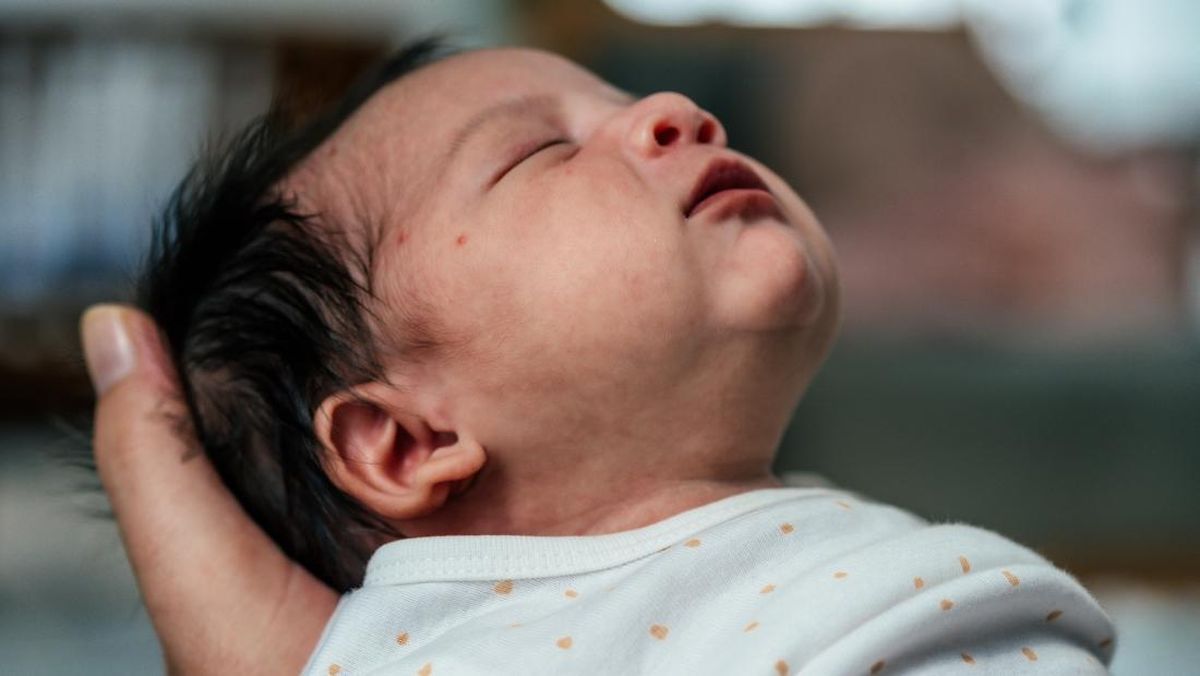 Waspadai Defisiensi Vitamin K yang Dapat Mengancam Nyawa Bayi